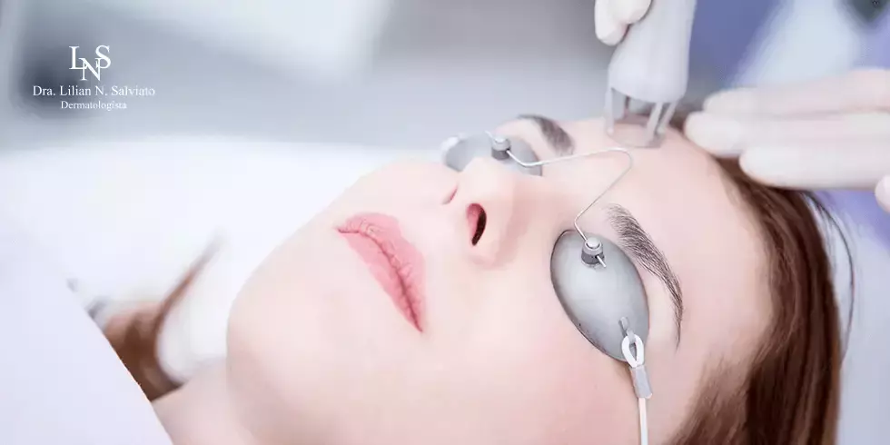 Tratamentos Dermatológicos a Laser