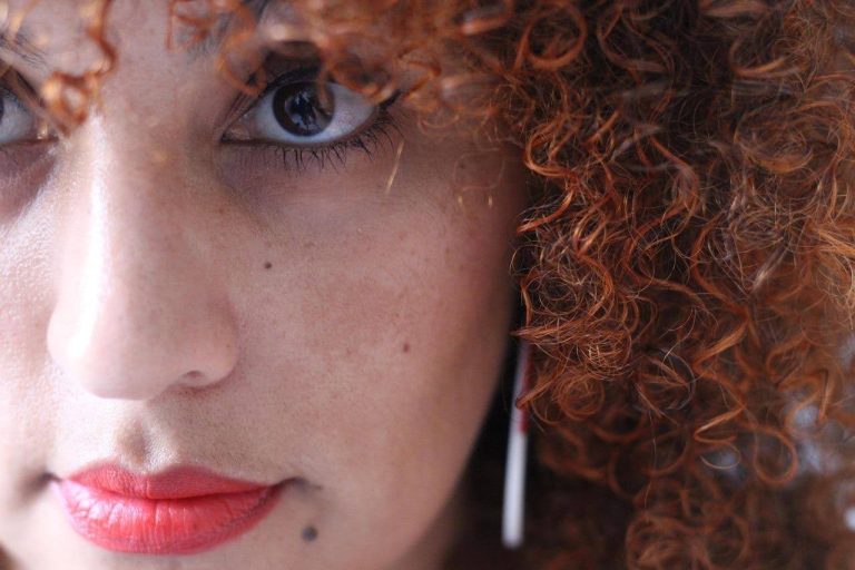 Read more about the article Melasma: Como Controlar as Manchas no Verão?