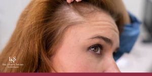 Queda de Cabelo: Quando é Normal e Quando Pode Ser Sinal de Alerta