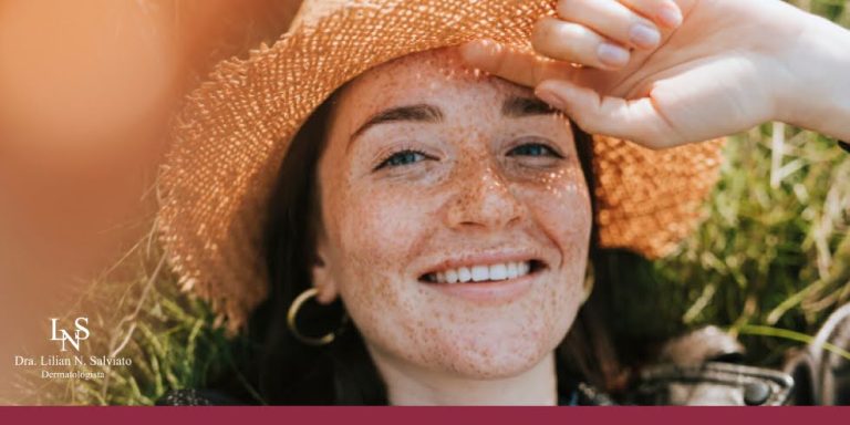 Read more about the article Sardas Pioram no Sol? Entenda Como o Sol Influencia as Manchas na Pele