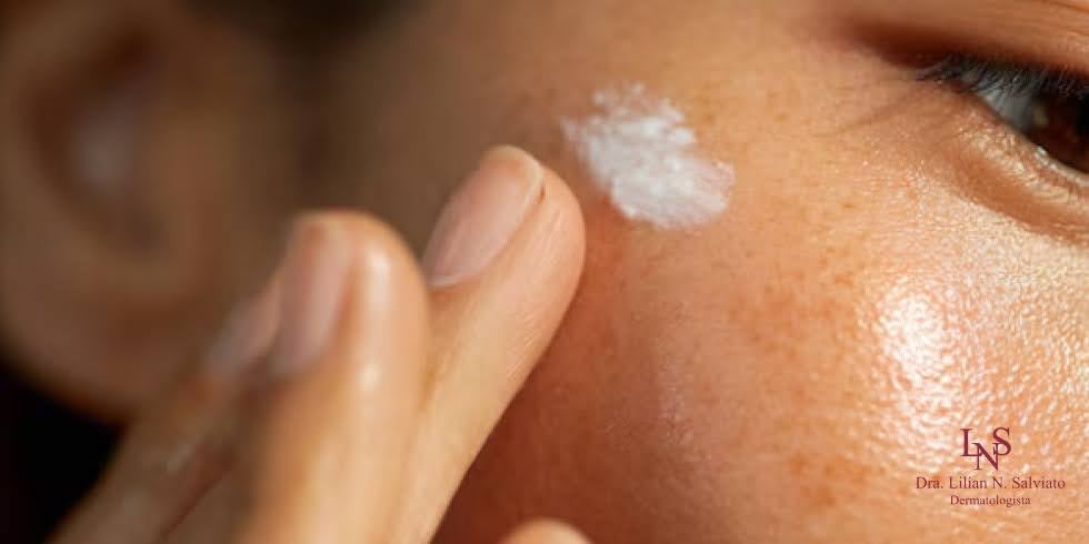 5 Erros Que Pioram o Melasma no Dia a Dia e Como Evitá-los